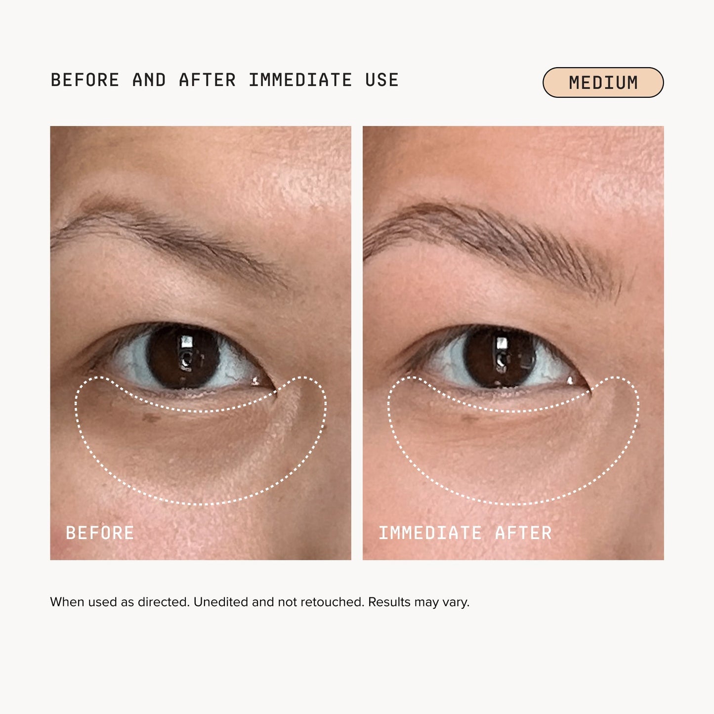 🎉Last Day Buy 1 Get 1 Free|Turonu Brightening Eye Corrector