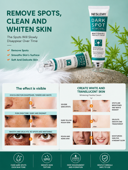 ✨Dark Spot Removal Cream That Helps Reveal Brighter, Healthier-Looking Skin