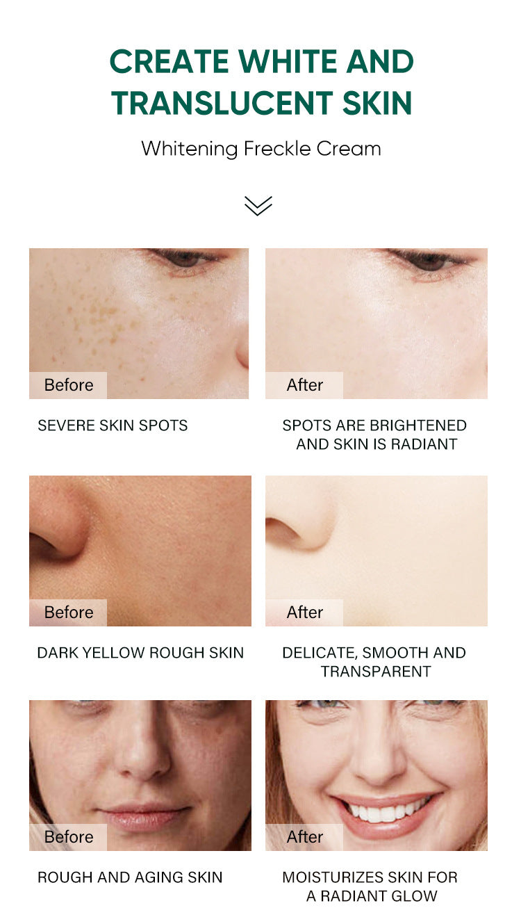 ✨Dark Spot Removal Cream That Helps Reveal Brighter, Healthier-Looking Skin