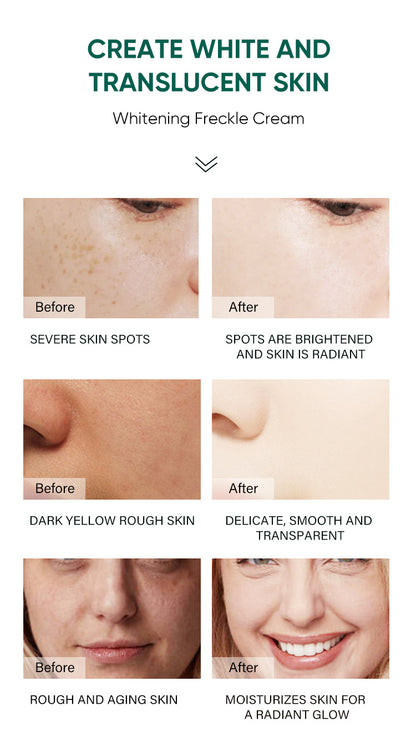 ✨Dark Spot Removal Cream That Helps Reveal Brighter, Healthier-Looking Skin