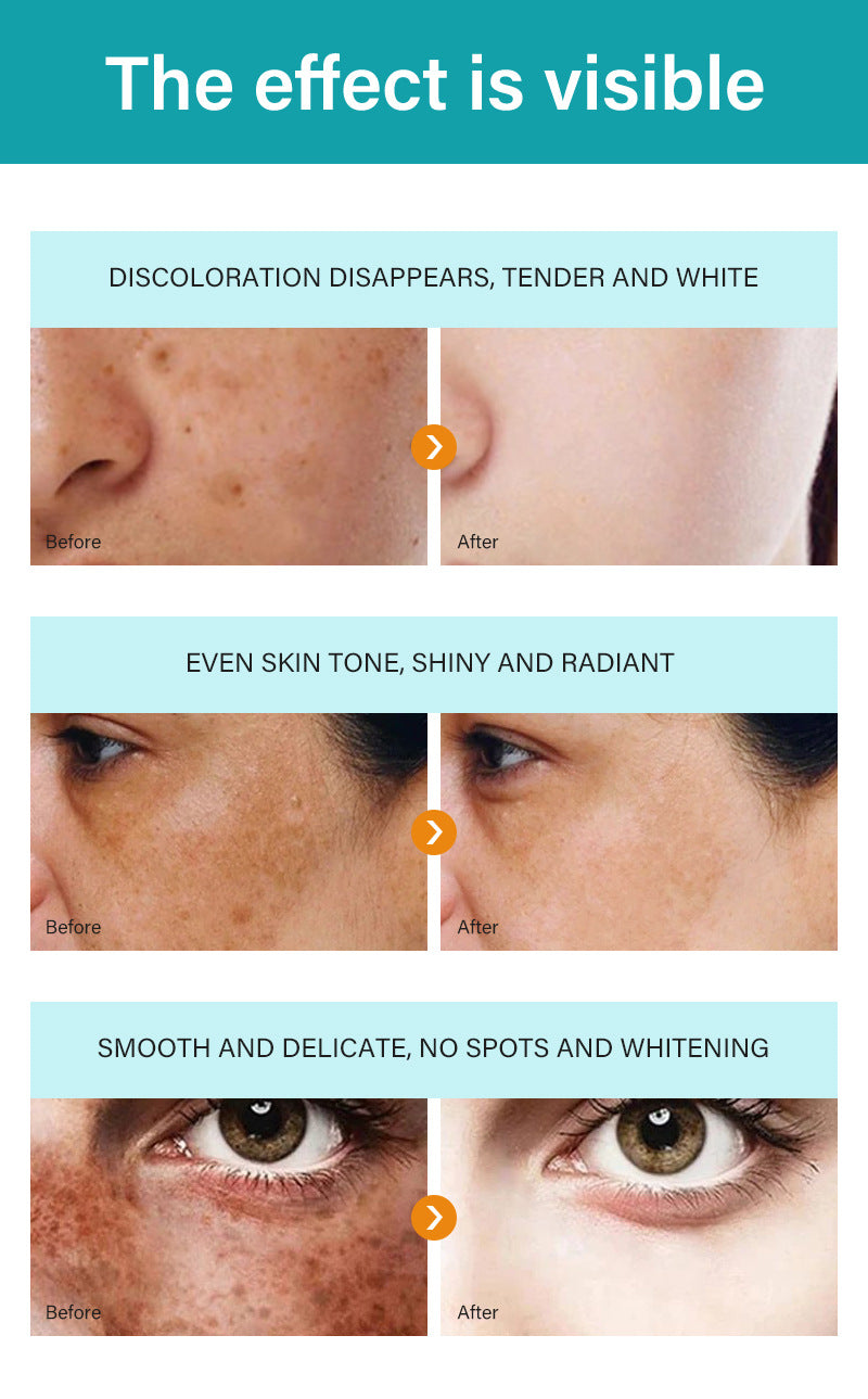 ✨Dark Spot Removal Cream That Helps Reveal Brighter, Healthier-Looking Skin