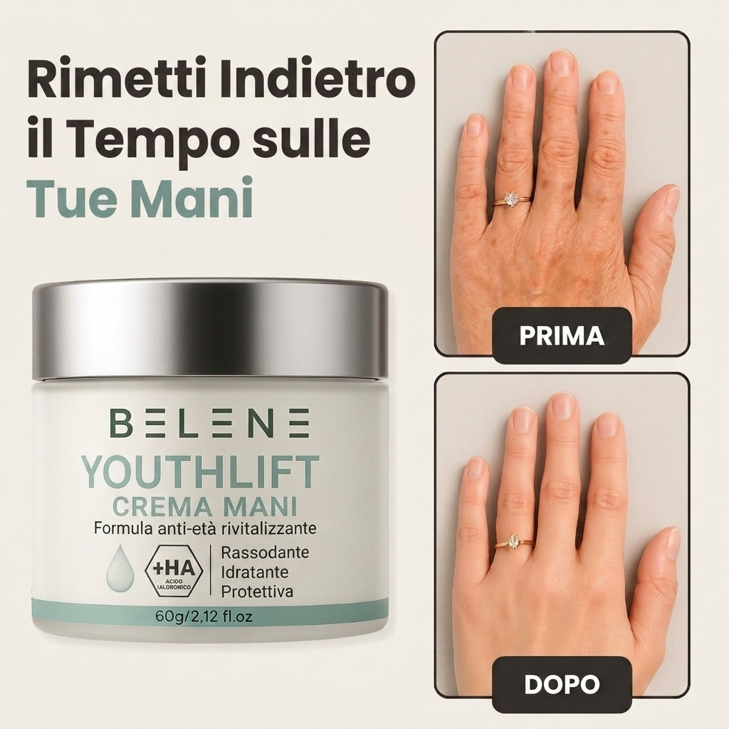 🏆 LIMITED-TIME 30% OFF! ✨Skavix™ YouthLift Retinol Hand Cream