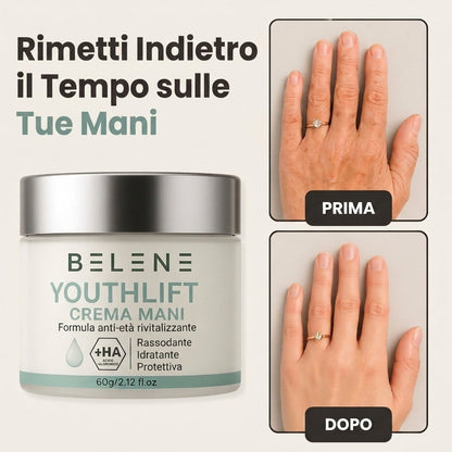 🏆 LIMITED-TIME 30% OFF! ✨Skavix™ YouthLift Retinol Hand Cream